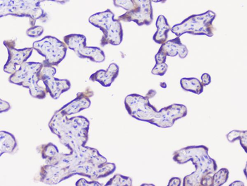 Anti-NSE/ENO2 Antibody