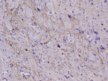 Anti-NSE/ENO2 Antibody