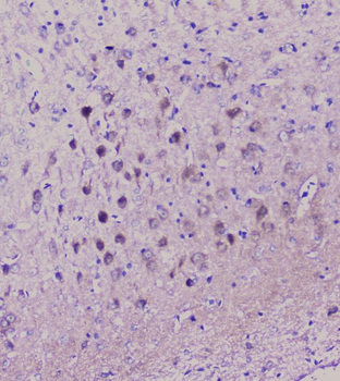 Anti-NSE/ENO2 Antibody
