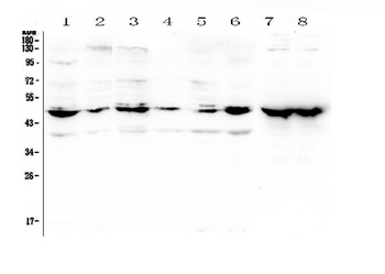 Anti-NSE/ENO2 Antibody
