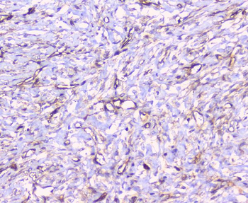 Anti-FCGR2A Antibody