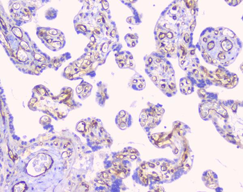 Anti-FCGR2A Antibody