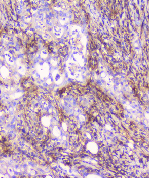 Anti-FCGR2A Antibody