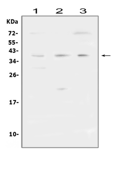 Anti-FCGR2A Antibody