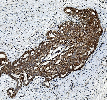 Anti-FGF2 Antibody