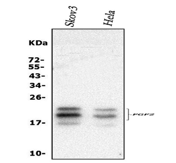 Anti-FGF2 Antibody