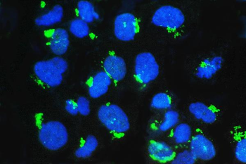 Anti-GM130/GOLGA2 Antibody