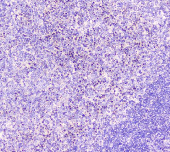 Anti-GM130/GOLGA2 Antibody