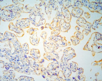 GM130/GOLGA2 Antibody