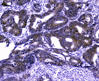Anti-GOLPH3 Antibody