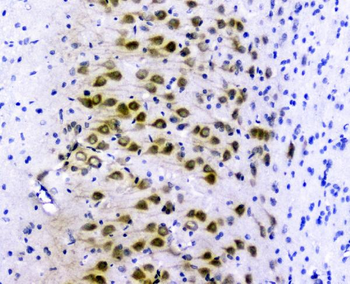 Anti-GOLPH3 Antibody
