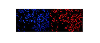 Anti-HMGN2 Antibody