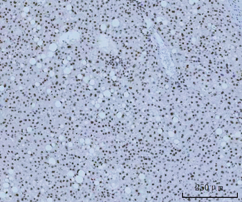 Anti-HMGN2 Antibody