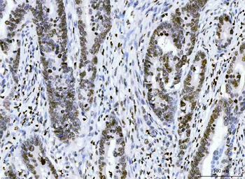 Anti-HMGN2 Antibody