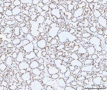 Anti-HMGN2 Antibody