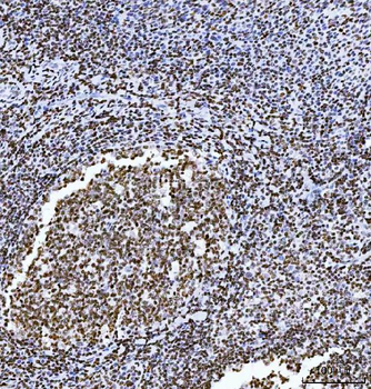 Anti-HMGN2 Antibody