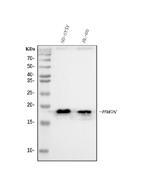 Anti-HMGN2 Antibody