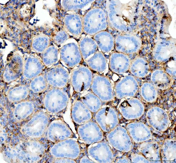 Anti-Interferon gamma/IFNG Antibody