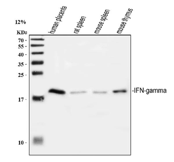 Anti-Interferon gamma/IFNG Antibody