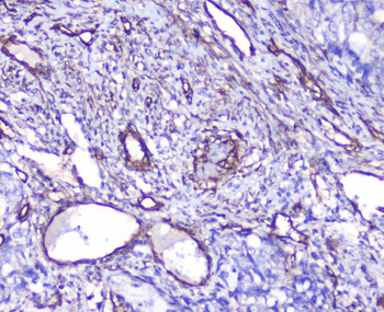 Anti-INPPL1 Antibody
