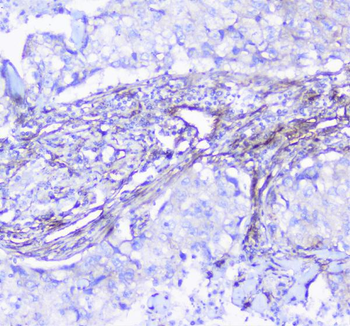 Anti-INPPL1 Antibody