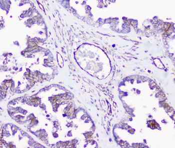Anti-INPPL1 Antibody