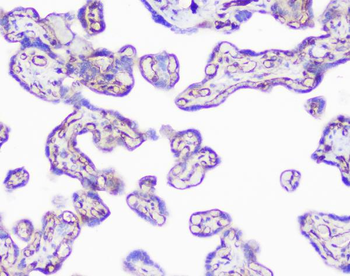 Anti-INPPL1 Antibody