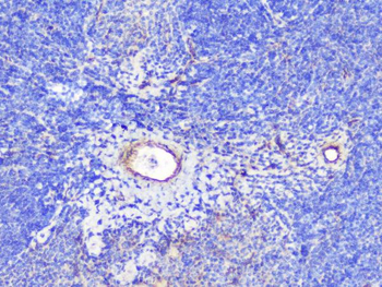 Anti-INPPL1 Antibody