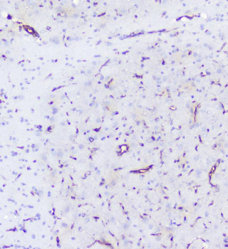 Anti-INPPL1 Antibody