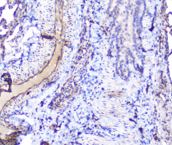 Anti-INPPL1 Antibody