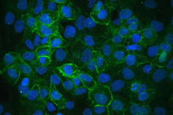 Anti-Integrin alpha 3/ITGA3 Antibody