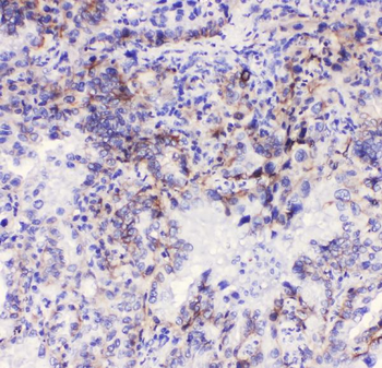 Anti-Integrin alpha 3/ITGA3 Antibody