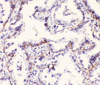 Anti-Integrin alpha 3/ITGA3 Antibody