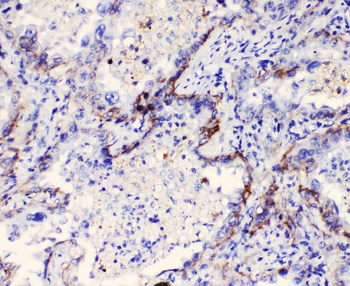 Anti-Integrin alpha 3/ITGA3 Antibody