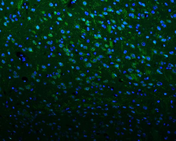 Anti-Kv1.1 potassium channel/KCNA1 Antibody
