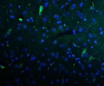 Anti-Kv1.1 potassium channel/KCNA1 Antibody