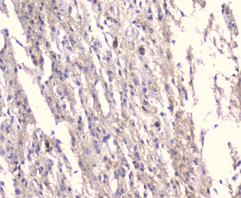 Anti-Kv1.1 potassium channel/KCNA1 Antibody