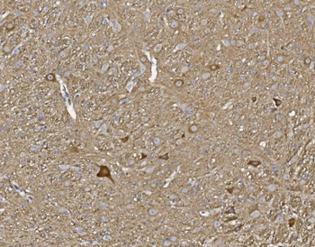 Anti-Kv1.1 potassium channel/KCNA1 Antibody