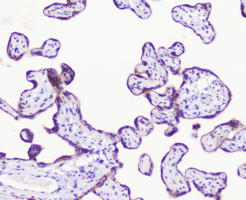 Anti-LATS1 Antibody