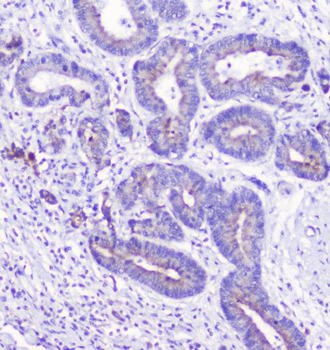 Anti-LATS1 Antibody