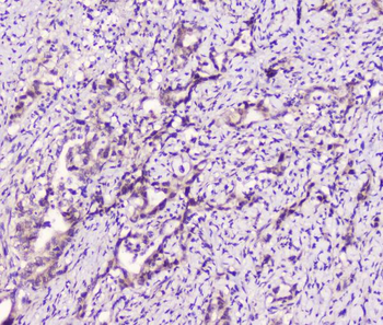 Anti-LATS1 Antibody