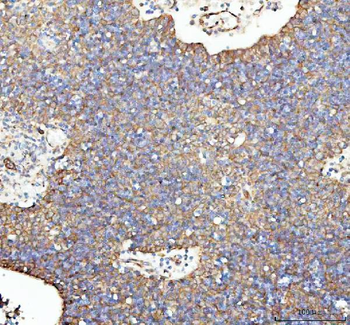 Anti-LMAN1 Antibody
