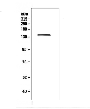 Anti-LRIG1 Antibody
