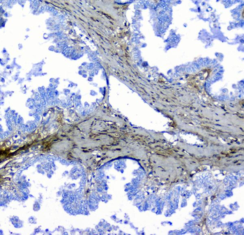 Anti-Lumican Antibody