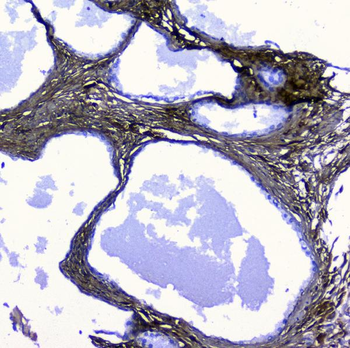 Anti-Lumican Antibody
