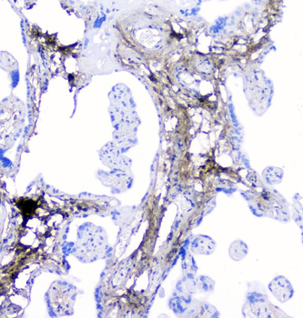 Anti-Lumican Antibody