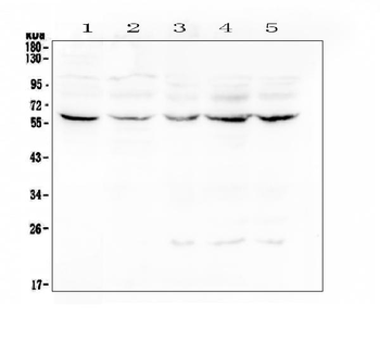 Anti-Lumican Antibody