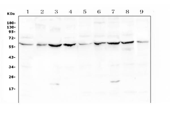Anti-Lumican Antibody