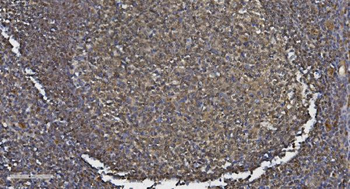 Anti-MEF2C Antibody
