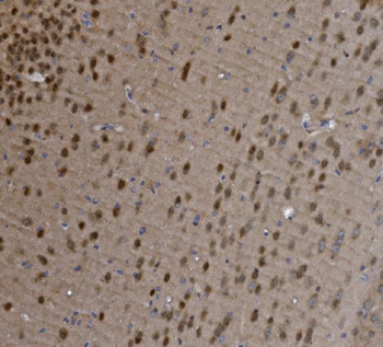 Anti-MEF2C Antibody